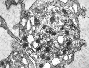 thrombocyte thrombocyte